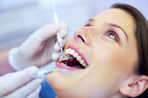 Quy trình và chi phí tẩy trắng răng 2
