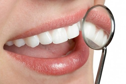 Bọc răng sứ khắc phục các khuyết điểm của răng