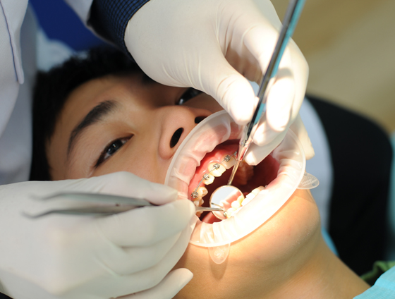 Kiểm tra tình trạng răng tại Nha Khoa