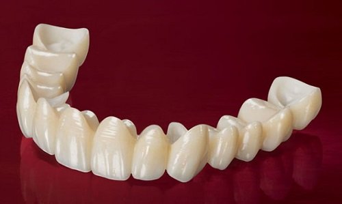 Vật liệu chế tác răng sứ thẩm mỹ 1