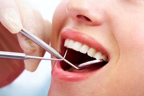 Lợi ích của việc trồng răng Implant là gì?