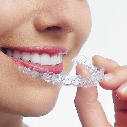 Có nên dùng máng điều trị nghiến răng?