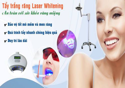 Tẩy trắng răng Laser Whitening