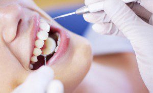 Chảy máu răng nên làm gì để khắc phục? 3