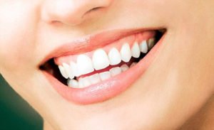 Chi phí trồng răng vĩnh viễn giá bao nhiêu? 1