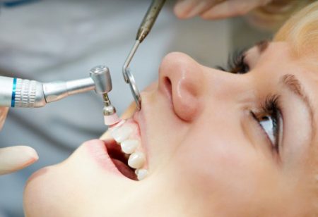 Cấy ghép Implant cho răng cửa thực hiện như thế nào? 2