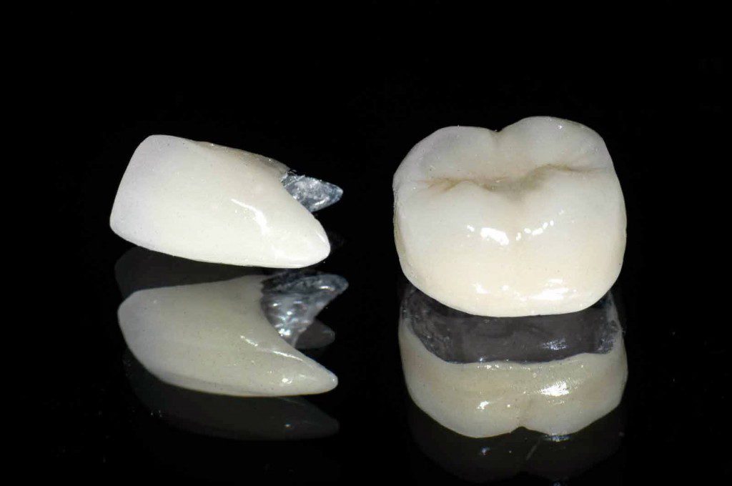 Độ bền của răng sứ thẩm mỹ 2