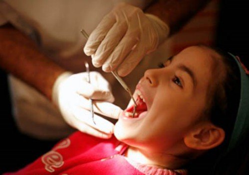 Niềng răng cho trẻ em nên thực hiện vào thời gian nào? 2