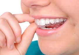 Niềng răng có đau không? Có hại cho sức khoẻ không? 2