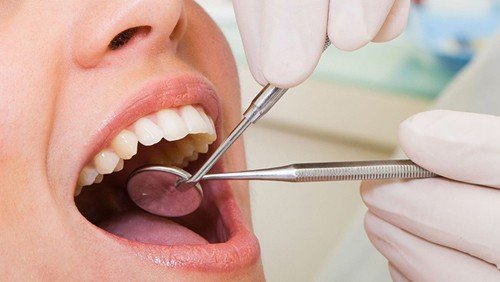 Dịch vụ chữa tủy răng tại trung tâm nha khoa 1