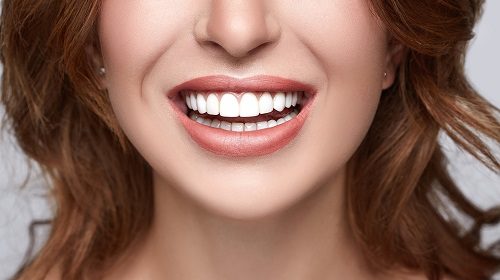Tẩy trắng răng bằng đèn plasma có hại không? 3