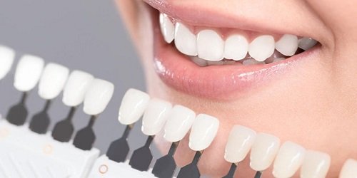 Trồng răng sứ loại nào tốt nhất? 3