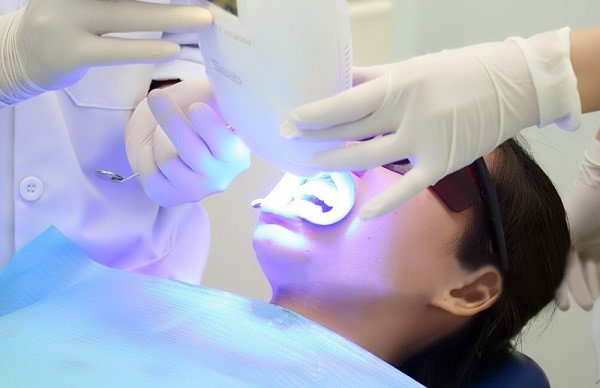 Công nghệ tẩy trắng răng đem lại an toàn và sự hài lòng