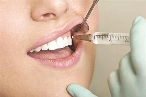 Trồng răng sứ có đau không? Tìm hiểu cách chăm sóc 2