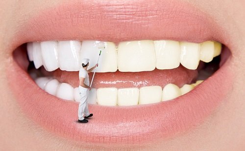 Tẩy trắng răng trong 1 tuần với cách làm nào? 3