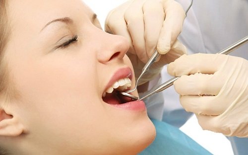 Trồng răng cửa hàm dưới với kỹ thuật nào? 3