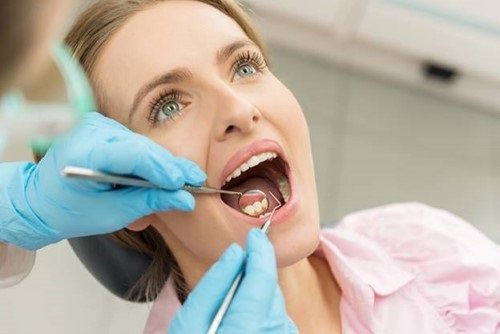 Bọc răng sứ cercon có đắt không? Tìm hiểu chi phí thực hiện 3