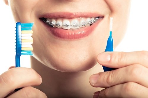 Niềng răng bị sưng lợi gây ra các biến chứng gì? 2