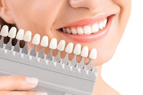 Bọc răng sứ có được vĩnh viễn không? Tìm hiểu ngay 2