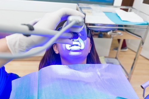 Tẩy trắng răng xong có được đánh răng không? Nha khoa giải đáp 1