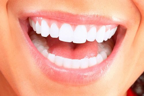 Bọc răng sứ cho răng cửa mọc lệch - Tham khảo 2