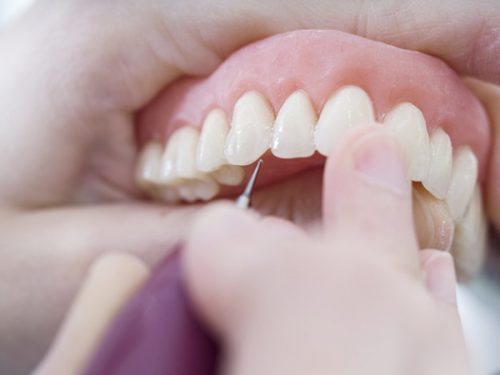 Làm răng sứ có đau không? Kinh nghiệm làm răng sứ 2