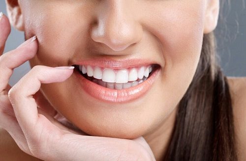 Niềng răng chỉnh hàm lệch - Giải pháp hiệu quả 3