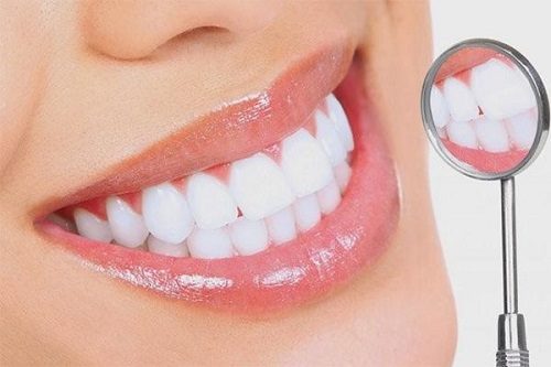 Làm răng sứ mất bao lâu là có hàm răng đẹp? 1