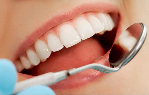 Bọc răng hàm bị sâu có đau không? Cách thực hiện 2