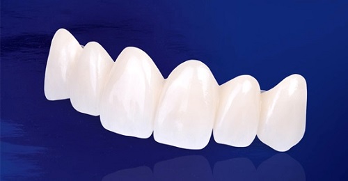 Làm răng sứ thẩm mỹ loại nào tốt? Lời khuyên từ nha khoa 2