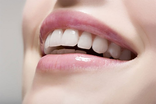 Làm răng sứ thẩm mỹ ở đâu đẹp và hiệu quả? 2