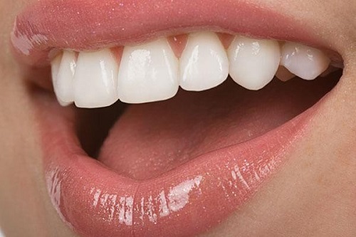 Làm răng sứ thẩm mỹ ở đâu đẹp và hiệu quả? 3