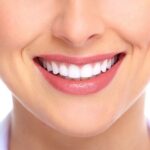 Bọc răng sứ có tác hại gì không - Lưu ý khi bọc răng sứ