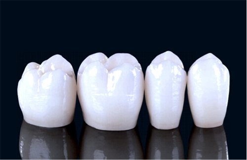 Trồng răng giả có lâu không? Các bước thực hiện 3